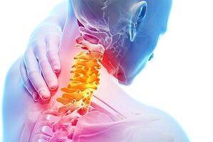 Symptômes de l'ostéochondrose cervicale et des règles de nutrition pour la maladie