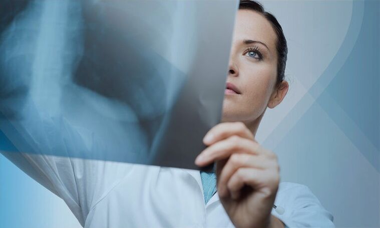 un médecin examine un instantané de la colonne cervicale avec ostéochondrose