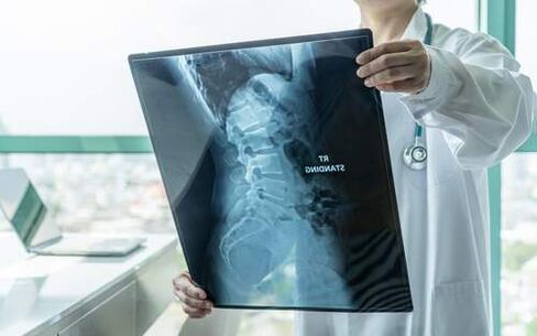 La radiographie est une méthode de diagnostic nécessaire si le dos fait mal